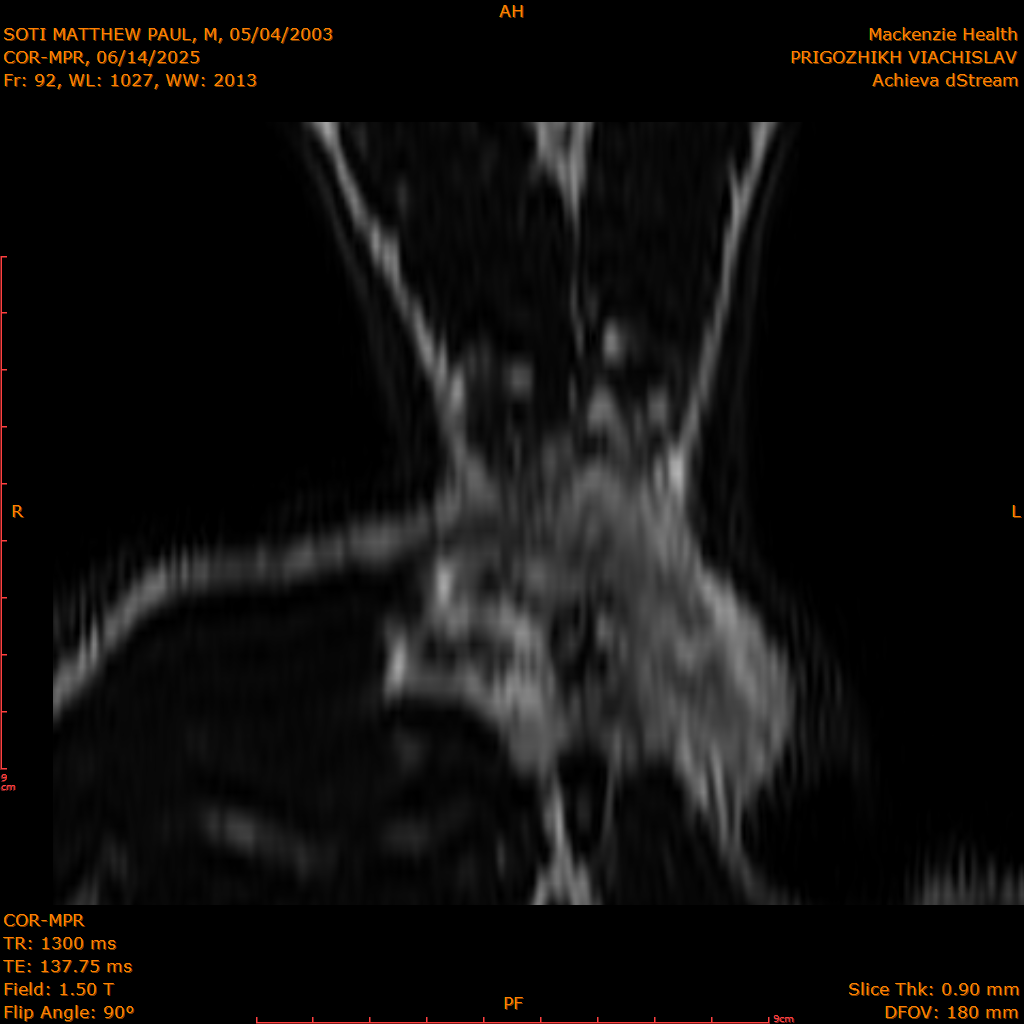 2025-06-14/COR-MPR/0093-IM178.png