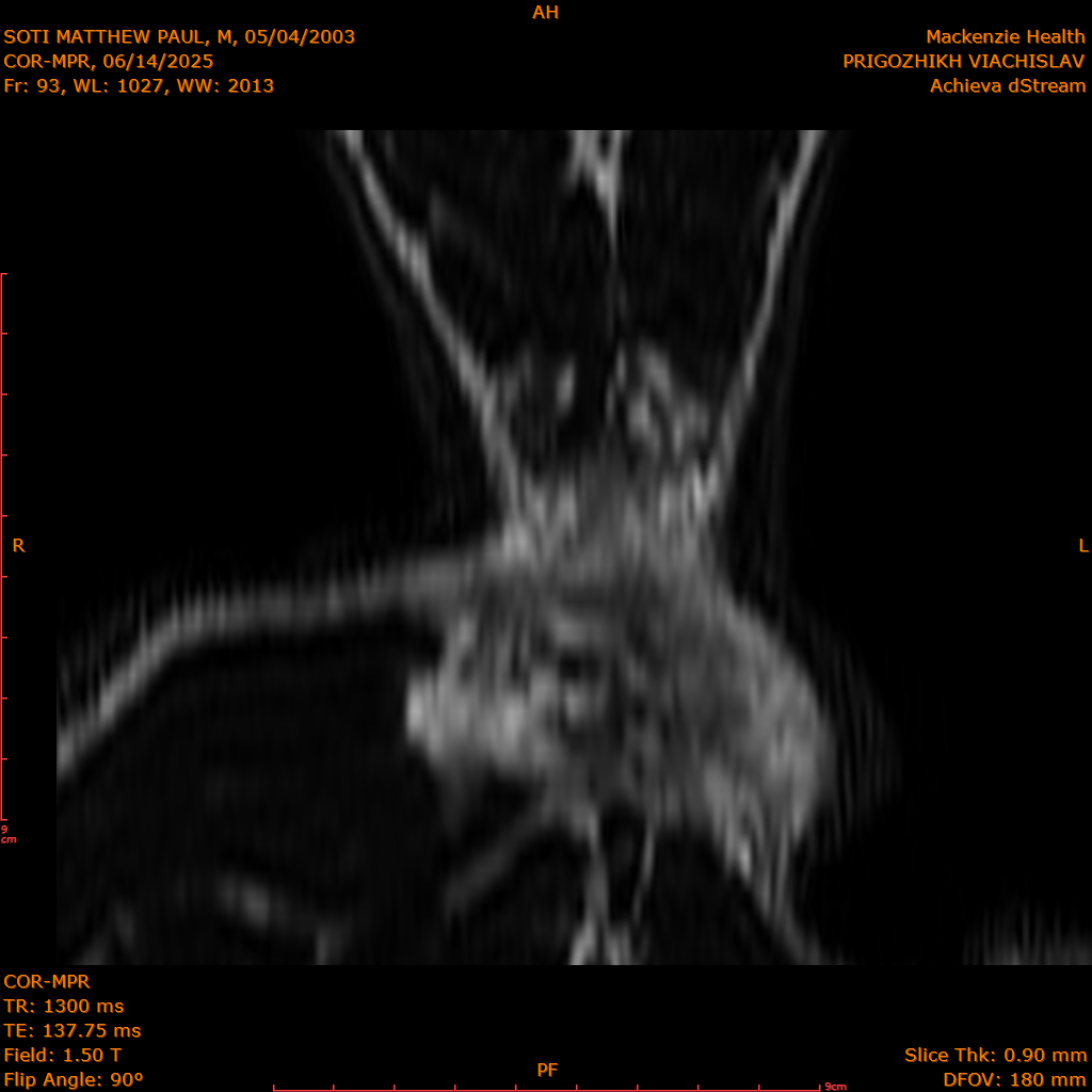 2025-06-14/COR-MPR/0094-IM179.png