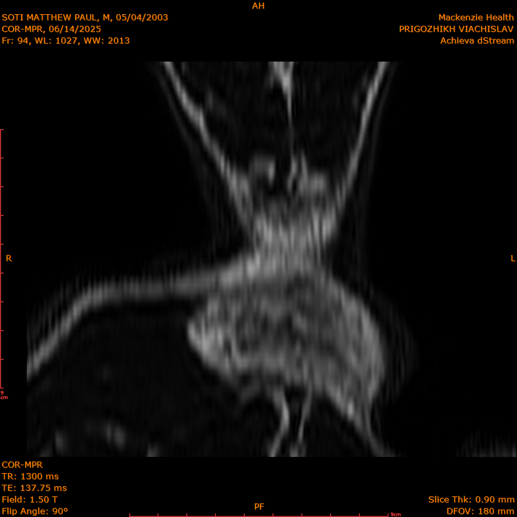 2025-06-14/COR-MPR/0095-IM180.png