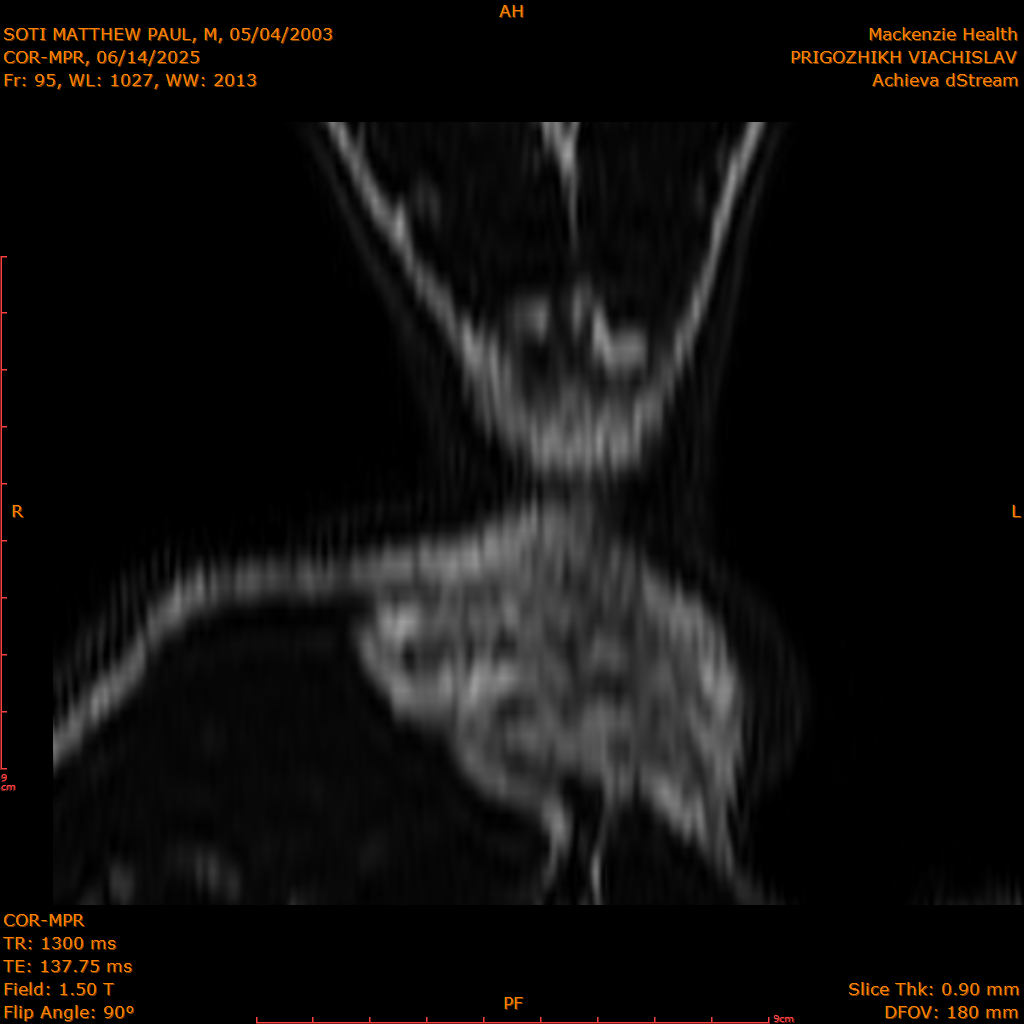 2025-06-14/COR-MPR/0096-IM181.png