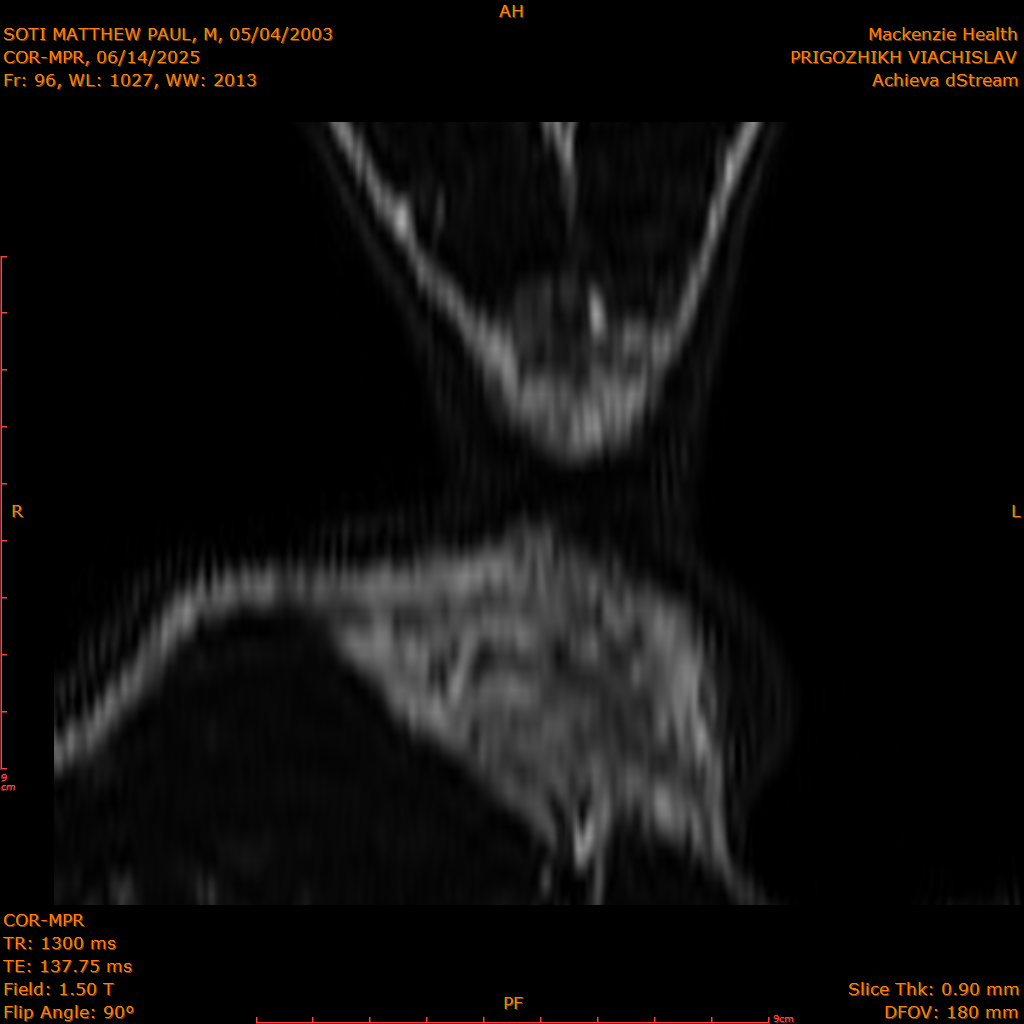 2025-06-14/COR-MPR/0097-IM182.png