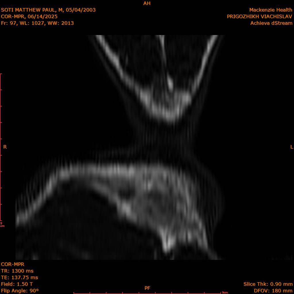 2025-06-14/COR-MPR/0098-IM183.png