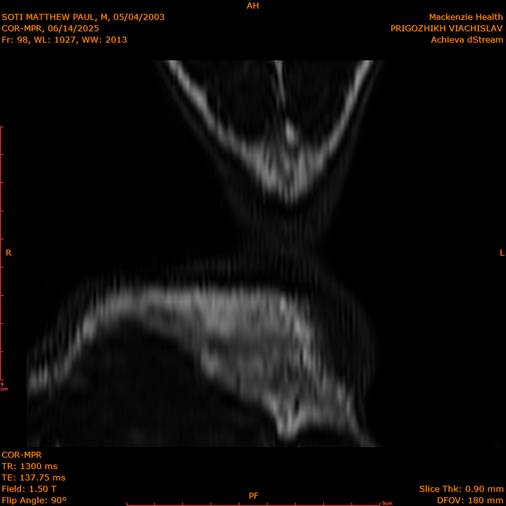 2025-06-14/COR-MPR/0099-IM184.png
