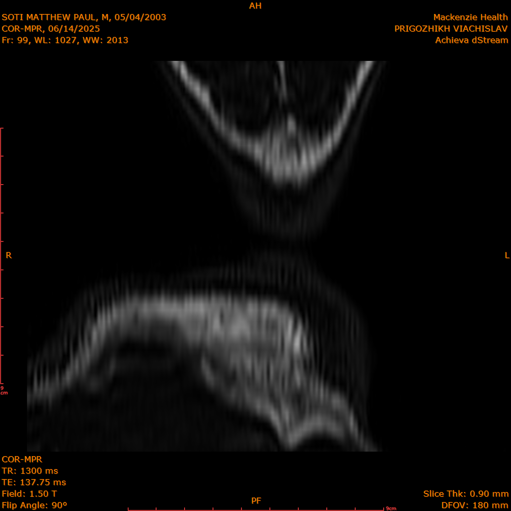 2025-06-14/COR-MPR/0100-IM185.png