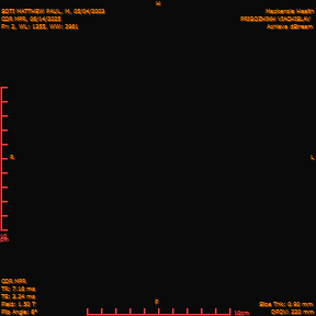 2025-06-14/COR_MPR/0003-IM348.png