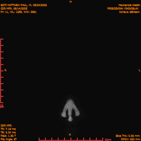 2025-06-14/COR_MPR/0012-IM358.png