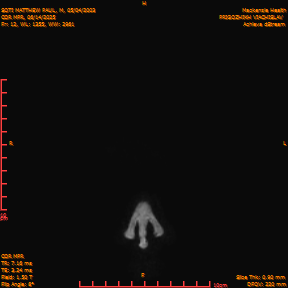2025-06-14/COR_MPR/0013-IM357.png