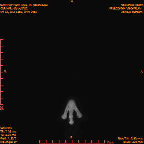 2025-06-14/COR_MPR/0014-IM359.png