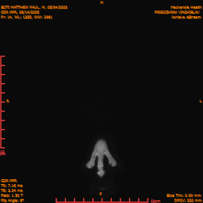 2025-06-14/COR_MPR/0015-IM360.png