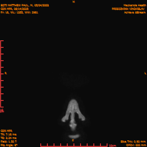 2025-06-14/COR_MPR/0017-IM362.png