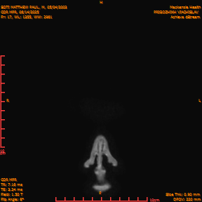 2025-06-14/COR_MPR/0018-IM363.png