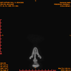 2025-06-14/COR_MPR/0019-IM364.png