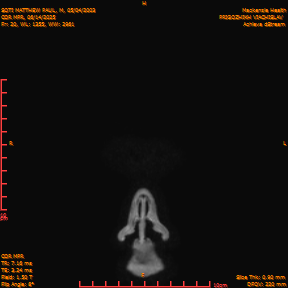 2025-06-14/COR_MPR/0021-IM366.png