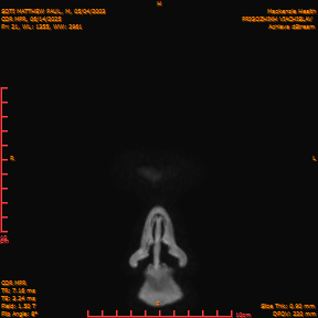 2025-06-14/COR_MPR/0022-IM367.png