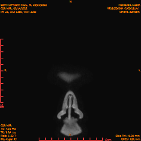 2025-06-14/COR_MPR/0023-IM368.png