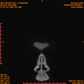 2025-06-14/COR_MPR/0024-IM369.png