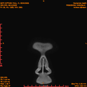 2025-06-14/COR_MPR/0026-IM371.png