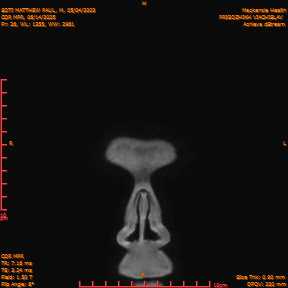 2025-06-14/COR_MPR/0027-IM372.png