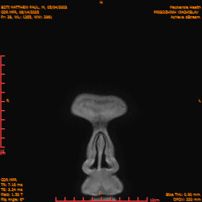 2025-06-14/COR_MPR/0029-IM374.png