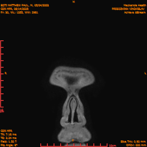 2025-06-14/COR_MPR/0031-IM376.png