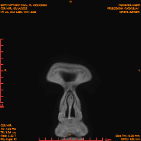 2025-06-14/COR_MPR/0032-IM378.png