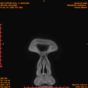 2025-06-14/COR_MPR/0033-IM377.png