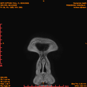 2025-06-14/COR_MPR/0034-IM380.png
