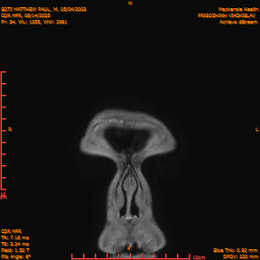 2025-06-14/COR_MPR/0035-IM379.png