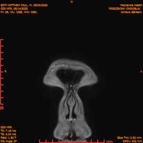 2025-06-14/COR_MPR/0036-IM381.png