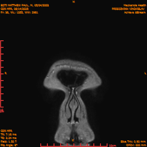 2025-06-14/COR_MPR/0037-IM382.png