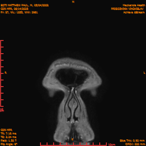 2025-06-14/COR_MPR/0038-IM383.png