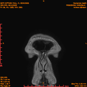 2025-06-14/COR_MPR/0039-IM384.png