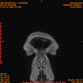 2025-06-14/COR_MPR/0040-IM385.png