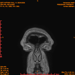 2025-06-14/COR_MPR/0042-IM387.png