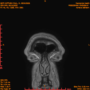 2025-06-14/COR_MPR/0043-IM388.png