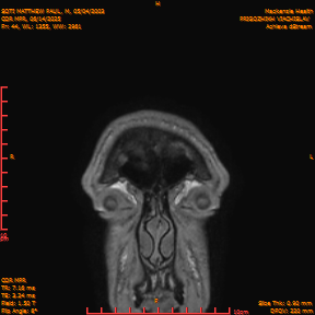 2025-06-14/COR_MPR/0045-IM390.png