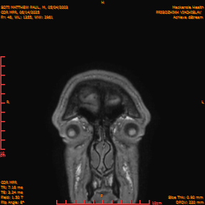 2025-06-14/COR_MPR/0047-IM392.png
