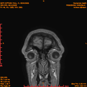 2025-06-14/COR_MPR/0049-IM394.png