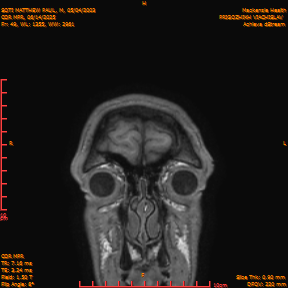 2025-06-14/COR_MPR/0050-IM395.png