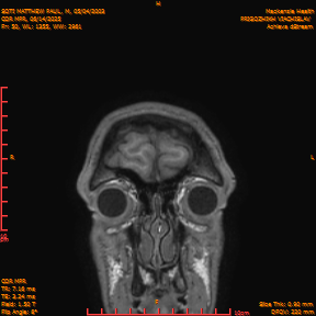 2025-06-14/COR_MPR/0051-IM396.png