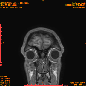 2025-06-14/COR_MPR/0052-IM397.png