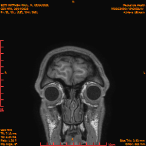 2025-06-14/COR_MPR/0053-IM398.png