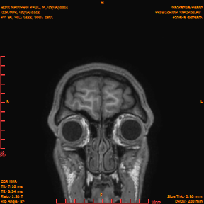 2025-06-14/COR_MPR/0055-IM400.png