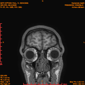 2025-06-14/COR_MPR/0058-IM403.png