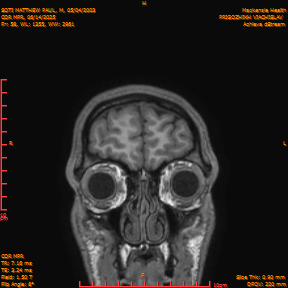 2025-06-14/COR_MPR/0059-IM404.png