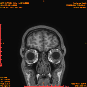 2025-06-14/COR_MPR/0060-IM405.png
