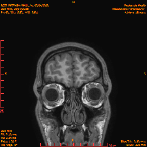 2025-06-14/COR_MPR/0061-IM406.png