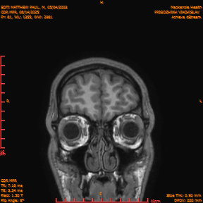2025-06-14/COR_MPR/0062-IM407.png