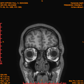 2025-06-14/COR_MPR/0063-IM408.png