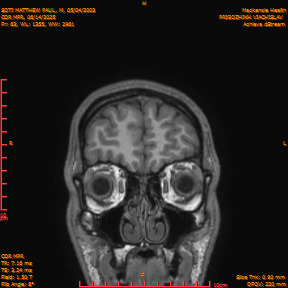 2025-06-14/COR_MPR/0064-IM409.png